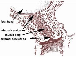 Image result for Cervical Mucus Plug