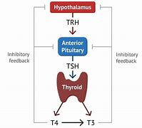 Image result for Types of Thyroid
