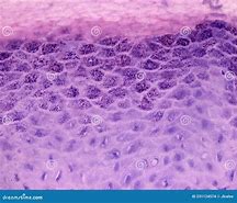 Image result for Different Warts
