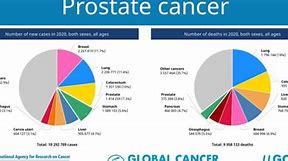 Image result for Diagnosed with Cancer