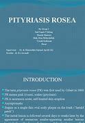 Image result for Pityriasis Rosea Rash