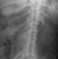 Image result for X-ray Urinary