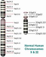 Image result for Chromosome 9 Map