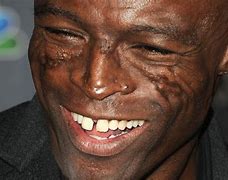 Image result for Seal Musician Scars