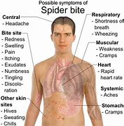 Image result for Brown Widow Spider California