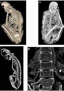 Image result for Skeleton Mummy