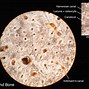 Image result for Molluscum Contagiosum Histology Image