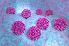 Image result for HPV 疣