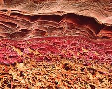 Image result for Eczema Under Microscope