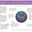 Image result for Cervix Dilation Chart Actual Size