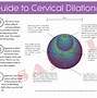 Image result for 10 Cm Cervix Dilation