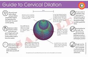 Image result for 10 Cm Dilated Cervix