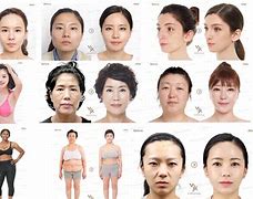 Image result for South Korea Plastic Surgery