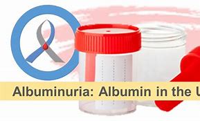 Image result for albumimuria