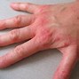Image result for OCD Hand Washing