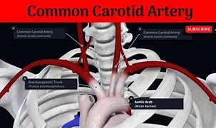 Image result for Carotid Artery Auscultation