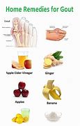 Image result for Gout Pain Relief