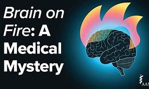 Image result for Brain On Fire Disease