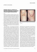 Image result for Verrucous Xanthoma