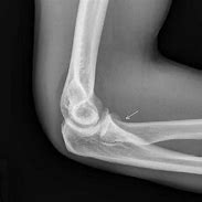 Image result for X-ray of a Motorcycle