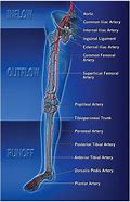 Image result for Revascularization Procedure of Leg