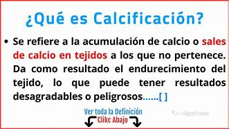 Image result for calcuficar