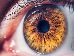 Image result for Early Detection of Alheimer's From Eye Exam