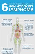 Image result for lymphoma