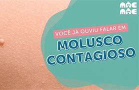 Image result for Molluscum Contagioso