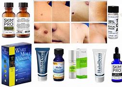 Image result for Skin Moles Removal Cream