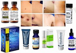 Image result for Cream for Mole Removal