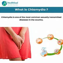 Image result for Chlamydia Female