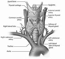 Image result for Thyroid Patient