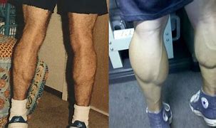 Image result for Men Calf Muscle