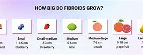 Image result for 8 Cm Fibroid Size
