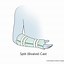 Image result for Leg Cast Drawing