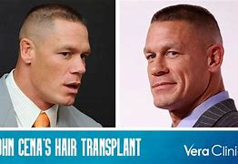 Image result for John Cena Bald Hair