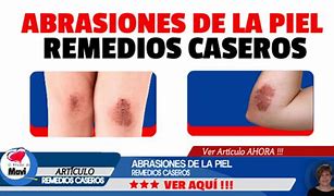 Image result for abrandamiento