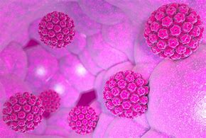 Image result for Human Papillomavirus Warts