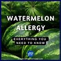 Image result for Watermelon Allergic Reaction