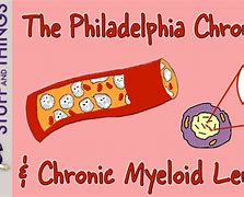 Image result for Philadelphia Chromosome Leukemia