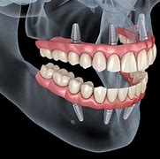 Image result for dentario