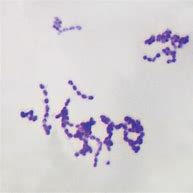 Image result for diplococcus_pneumoniae