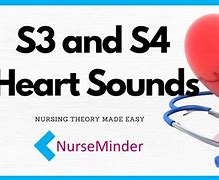 Image result for S3 and S4 Heart Sounds Images