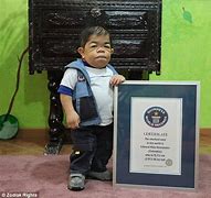 Image result for World Smallest Man Alive