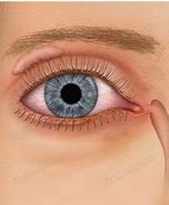 Image result for External Eye Anatomy