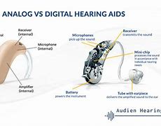 Image result for Analog vs Digital Hearing Aids