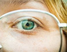 Image result for Glaucoma Glasses for Blurry Vision