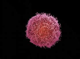 Image result for Skin Cancer Cells Under Microscope