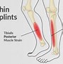 Image result for Shin Splints Injury